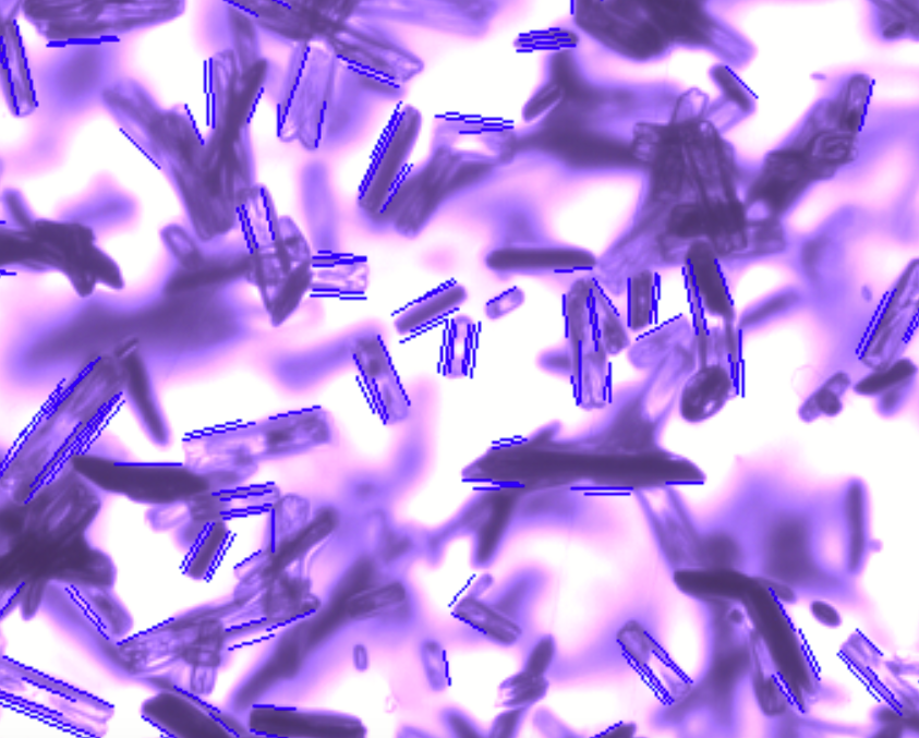 直线检测玻璃杂质